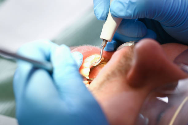 Best Pediatric Emergency Dentist in West New York, NJ